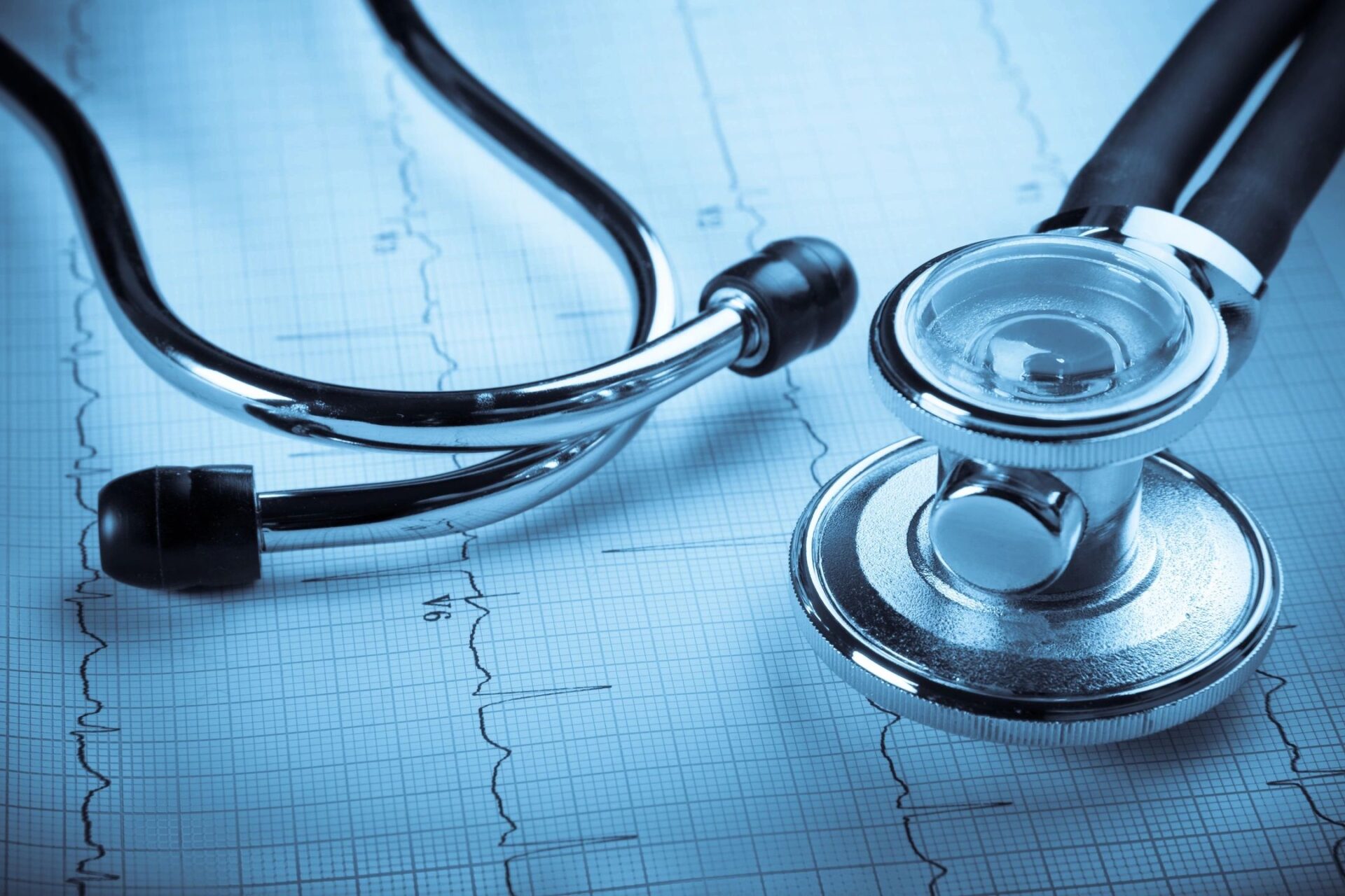 A stethoscope sitting on top of an ecg chart.